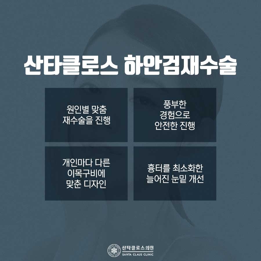 잠실하안검수술