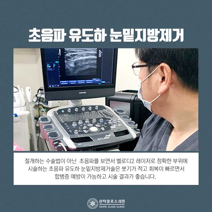 잠실하안검수술
