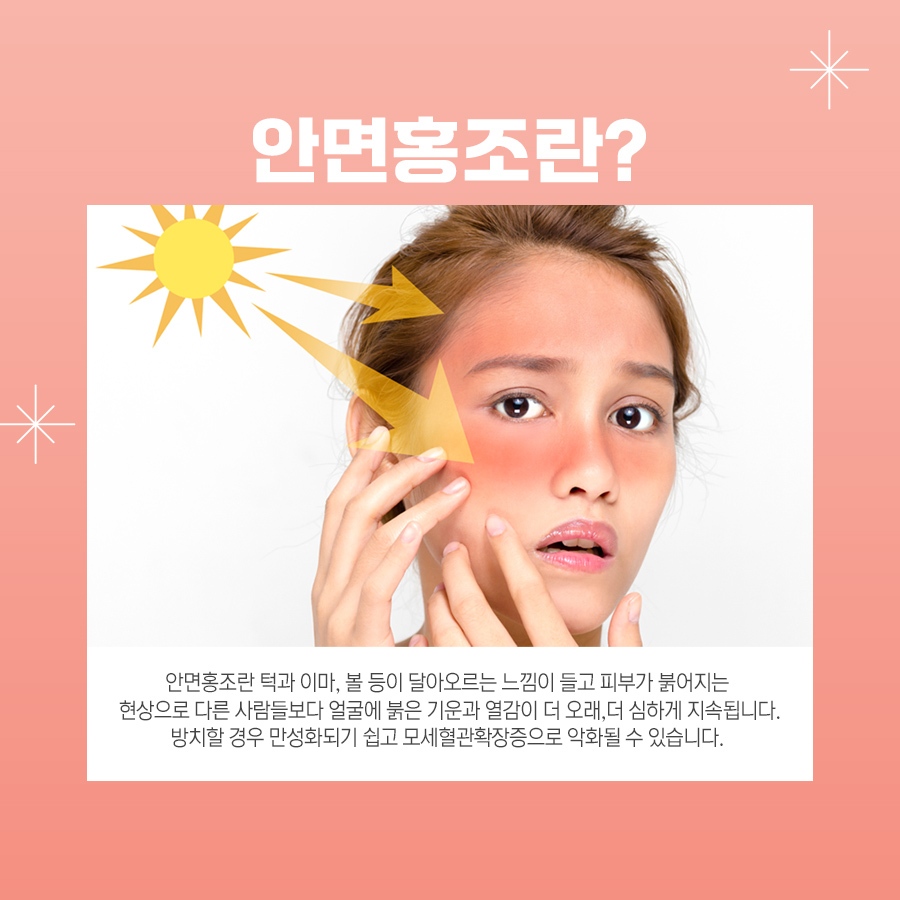 잠실안면홍조