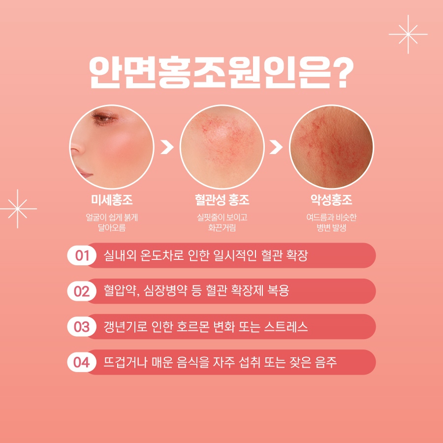 잠실안면홍조