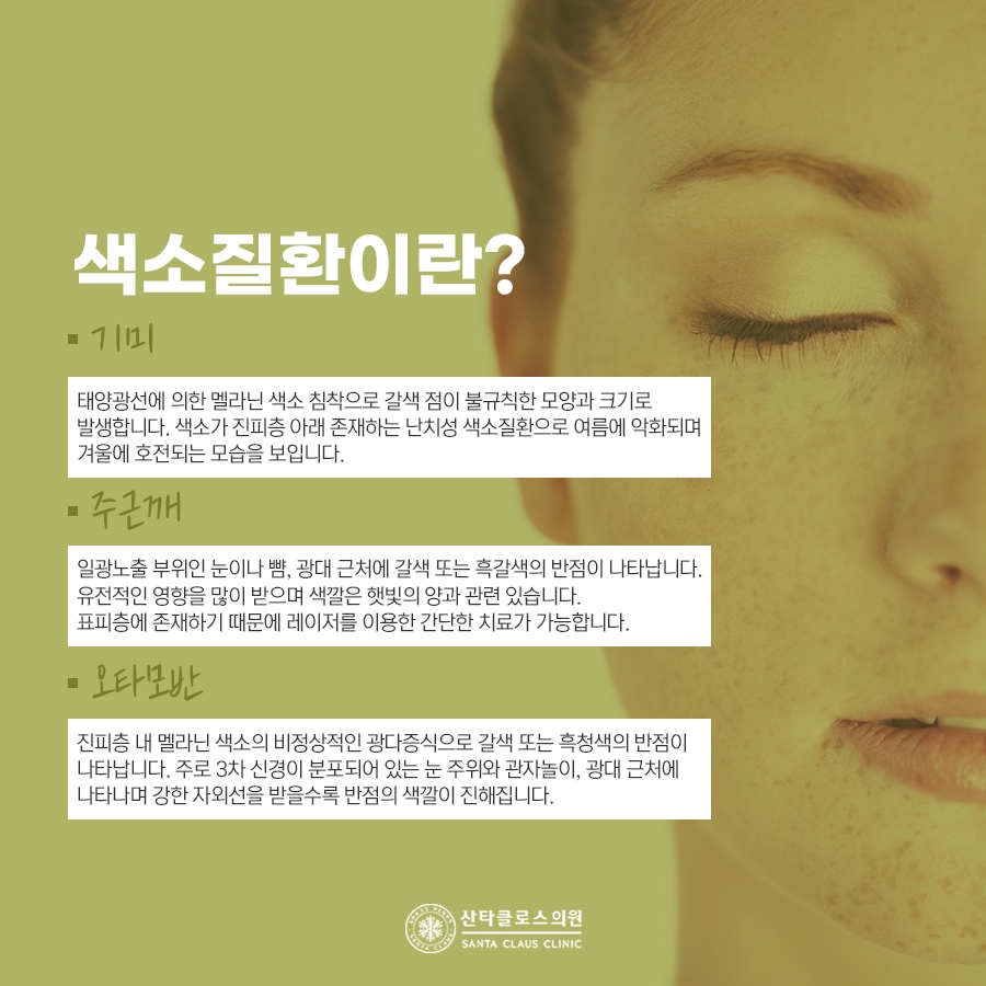 잠실색소치료
