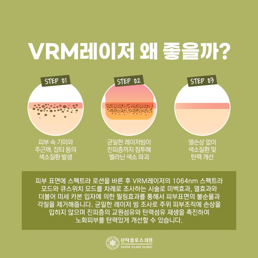 잠실색소치료